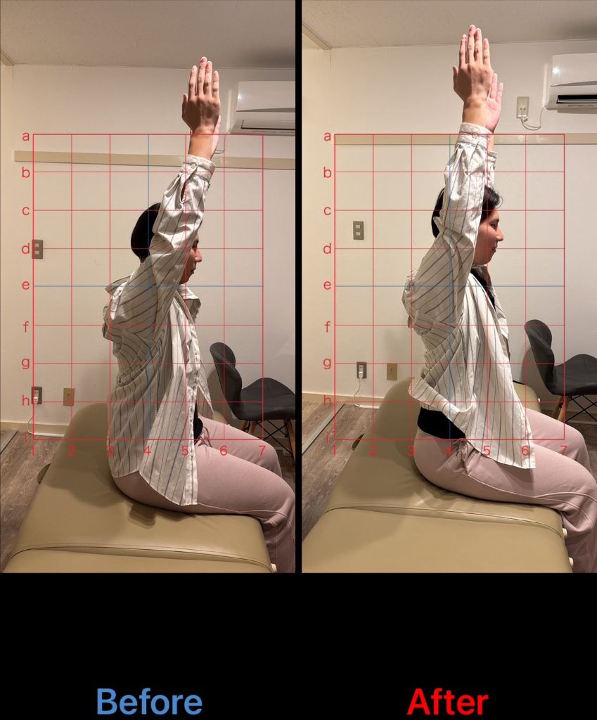 姿勢改善 施術結果11