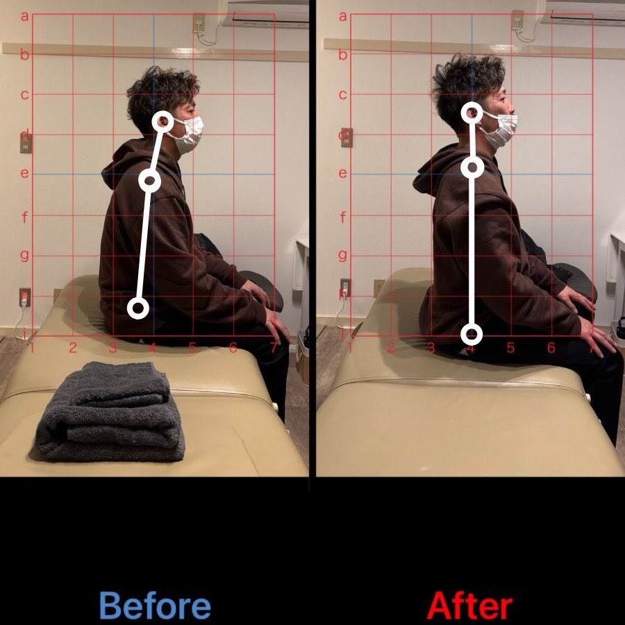 50代男性 ギックリ腰改善事例