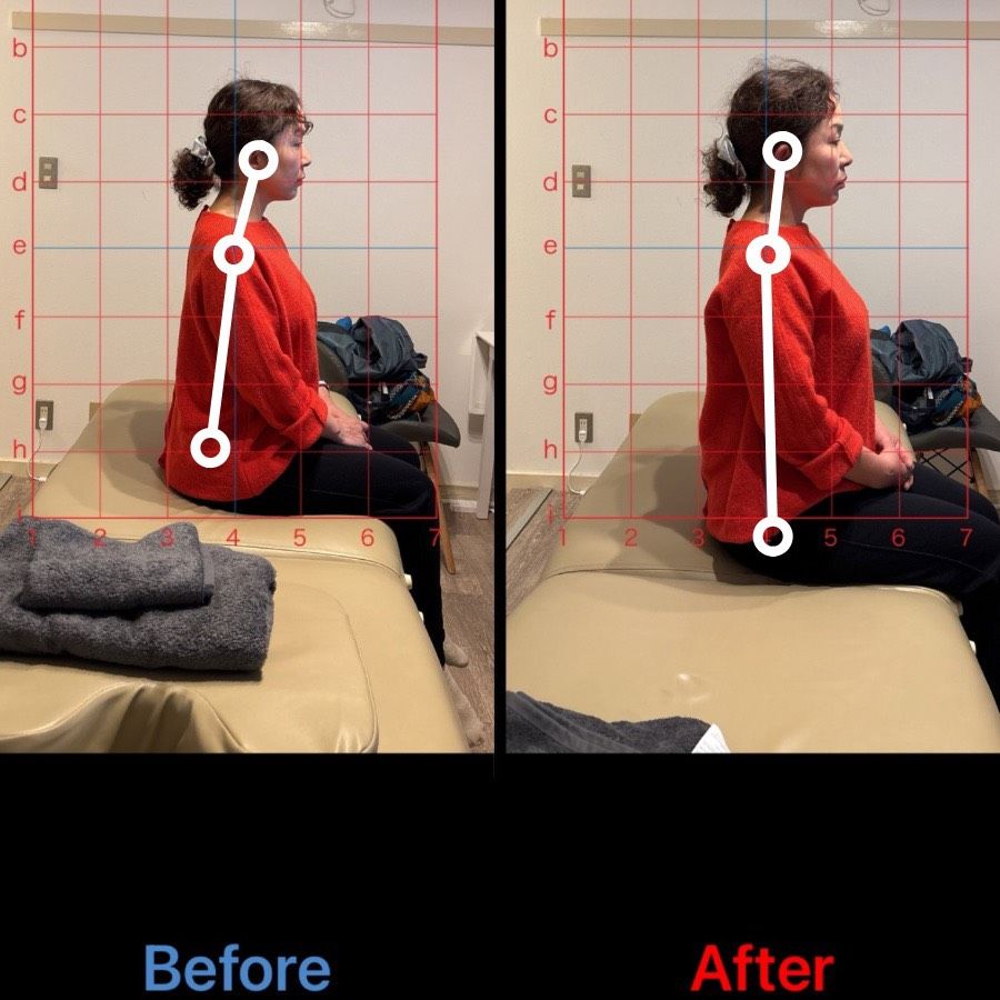 50代女性 ストレートネック改善事例