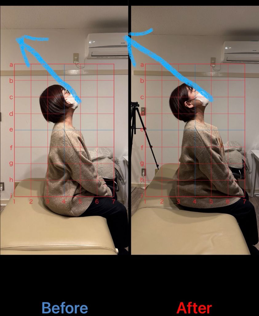 50代女性 腰痛・猫背改善事例