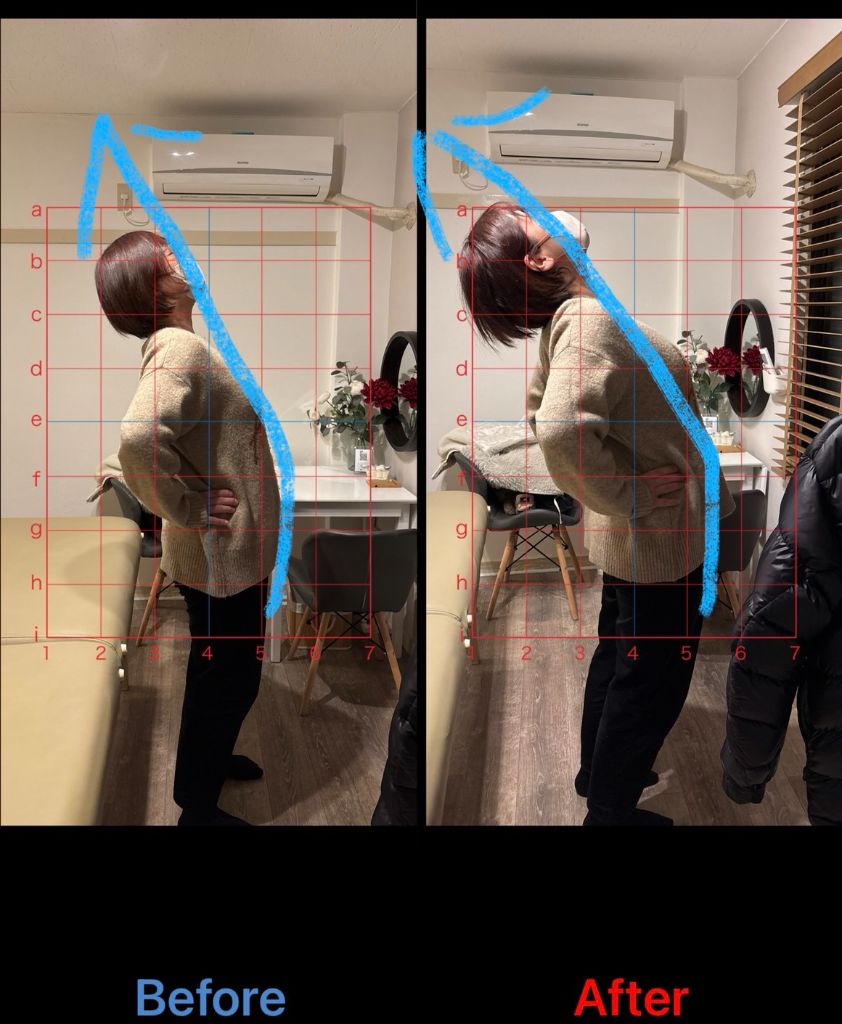 50代女性 腰痛・猫背改善事例2