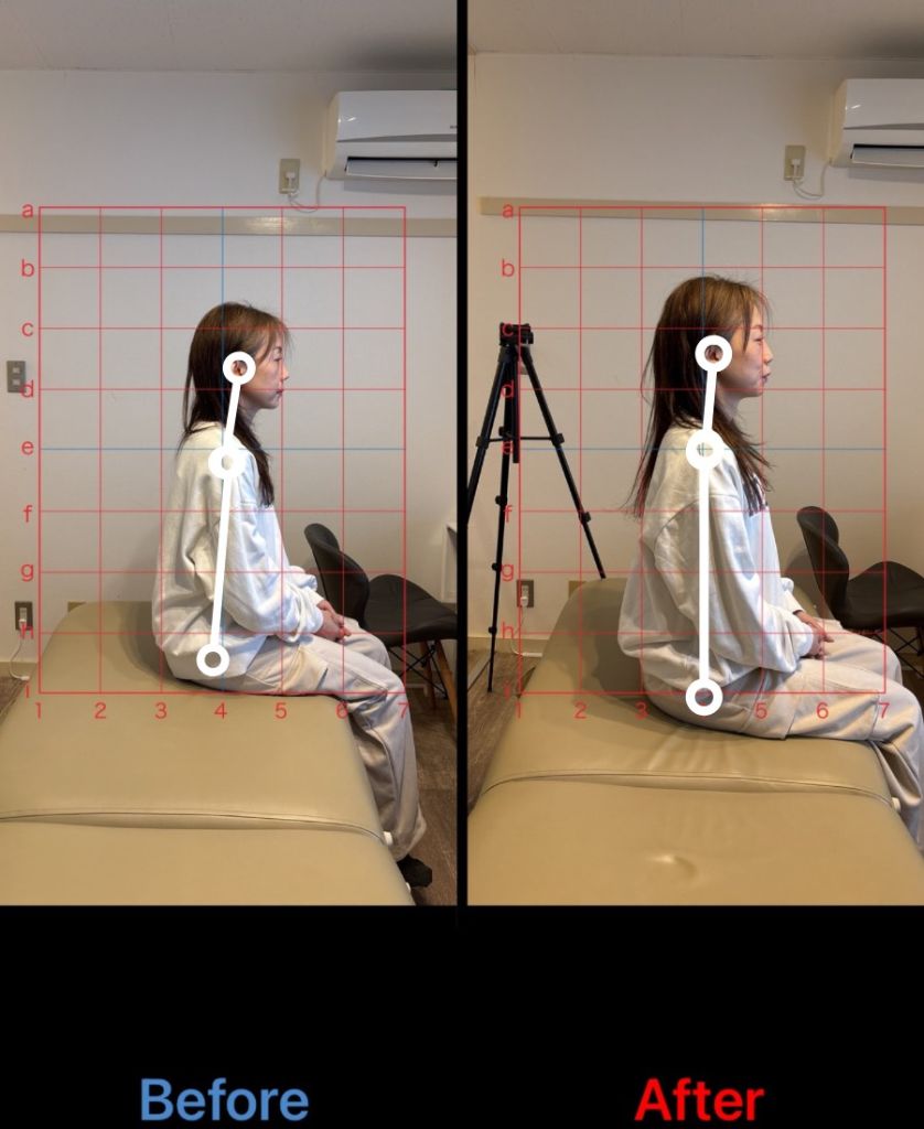 50代女性 猫背・腰痛改善事例